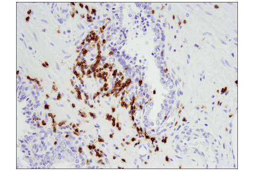 Immunohistochemistry Image 4: CD5 (E8X3S) XP<sup>®</sup> Rabbit mAb (BSA and Azide Free)