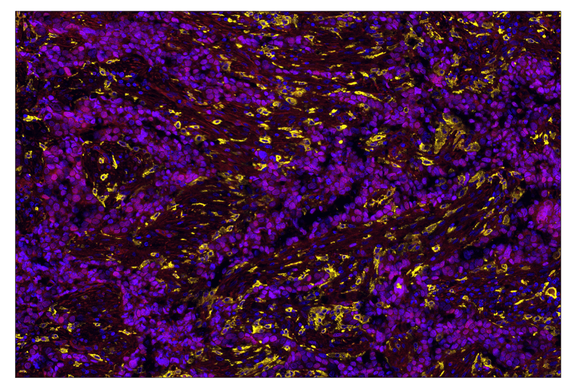 Immunohistochemistry Image 3: Ezh2 (D2C9) & CO-0167-594 SignalStar<sup>®</sup> Oligo-Antibody Pair