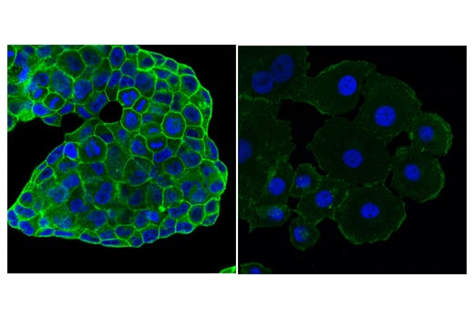 Immunofluorescence Image 1: Ras (E4K9L) Rabbit mAb