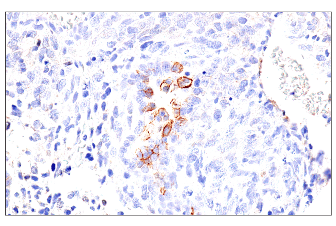 Immunohistochemistry Image 3: Syndecan 1 (E7F7T) Rabbit mAb