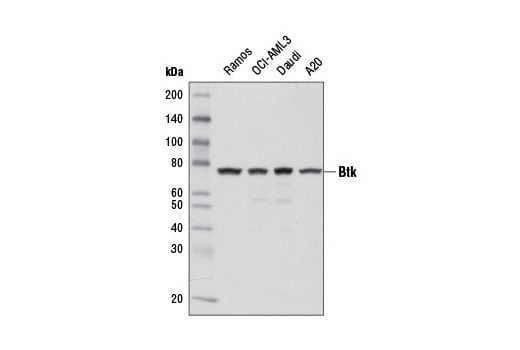 undefined Image 1: PhosphoPlus<sup>®</sup> Btk (Tyr223) Antibody Duet