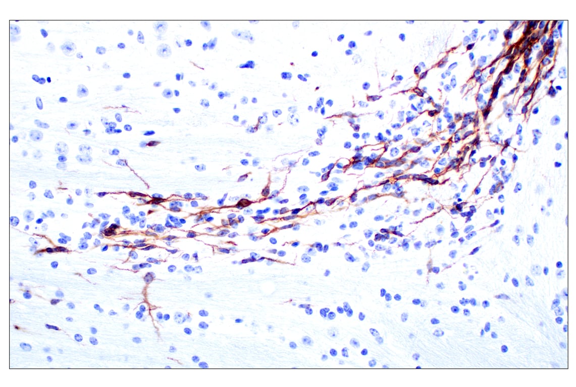 Immunohistochemistry Image 2: Doublecortin (E3S7L) Rabbit mAb (BSA and Azide Free)