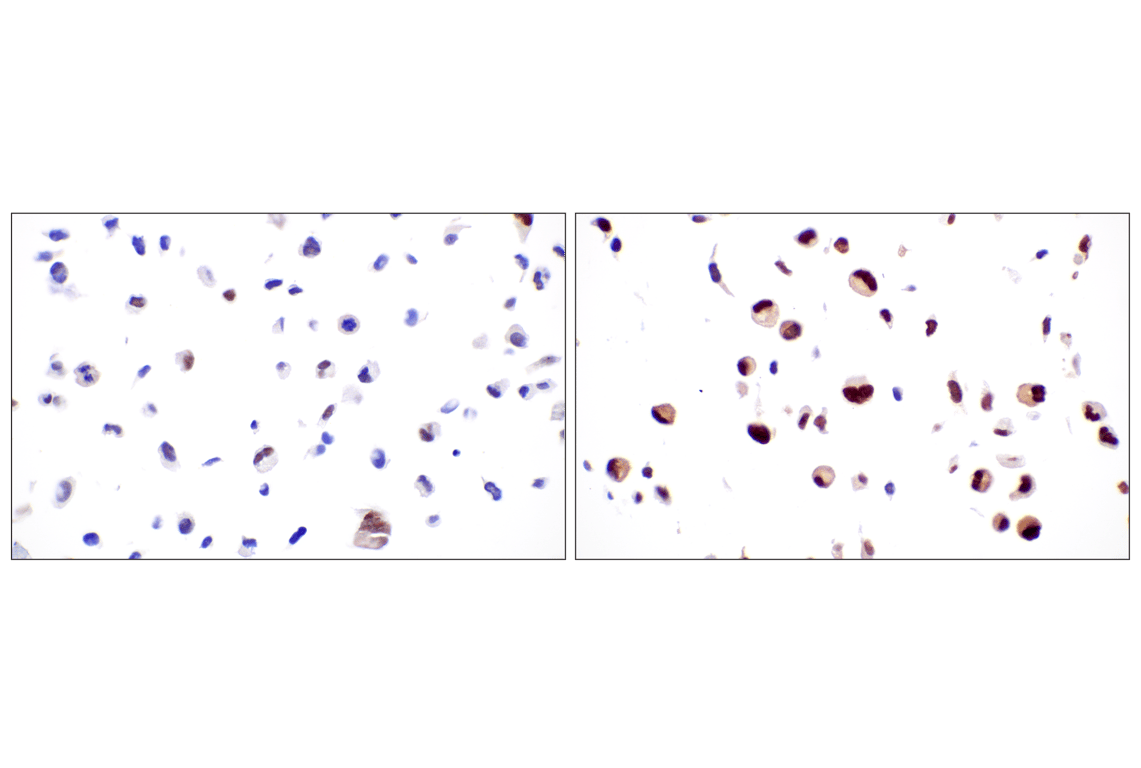 Immunohistochemistry Image 10: MDM2 (F7W7X) Rabbit mAb