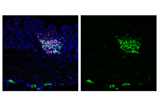 Immunofluorescence Image 3: IL-2Rα/CD25 (E9W2J) XP<sup>®</sup> Rabbit mAb