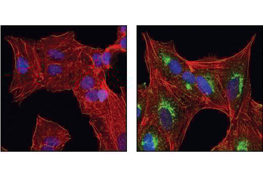 Immunofluorescence Image 1: βIG-H3 Antibody