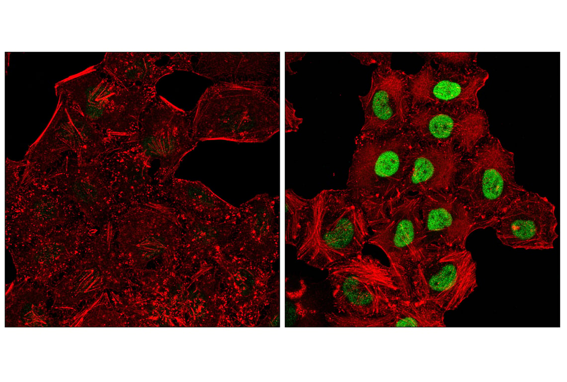 Immunofluorescence Image 1: c-Fos (E2I7R) XP<sup>®</sup> Rabbit mAb