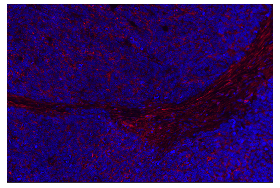 Immunohistochemistry Image 1: CD44 (E7K2Y) XP<sup>®</sup> Rabbit mAb (Alexa Fluor<sup>®</sup> 647 Conjugate)