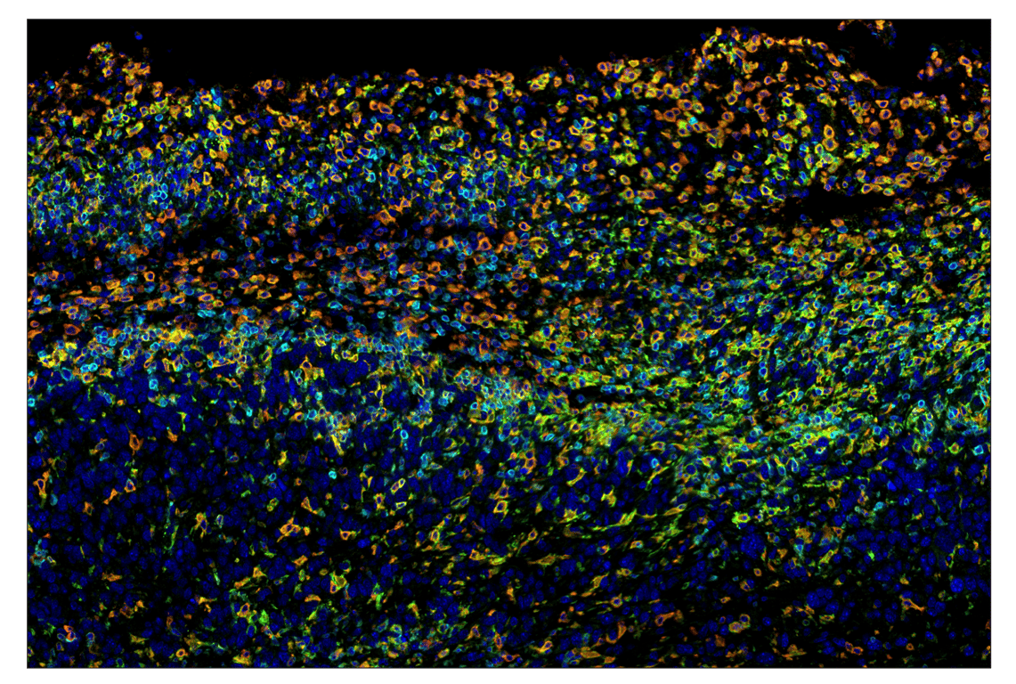 Immunohistochemistry Image 7: CD86 (E5W6H) & CO-0051-750 SignalStar<sup>™</sup> Oligo-Antibody Pair