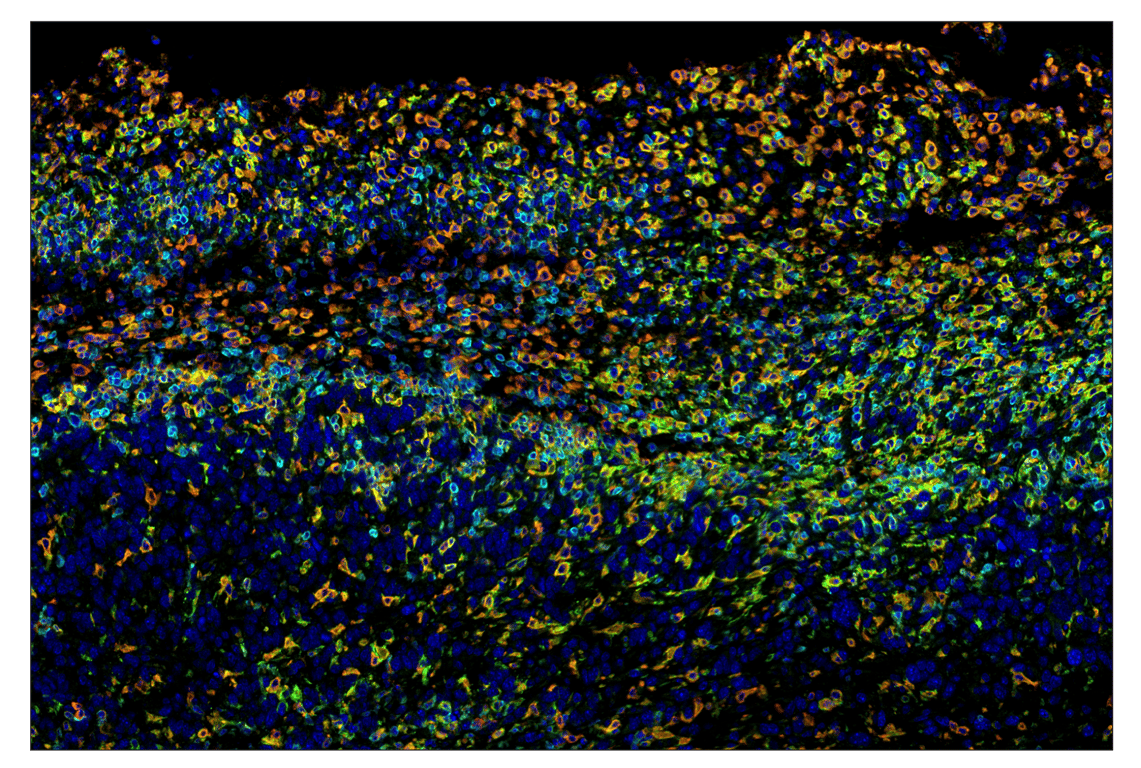 Immunohistochemistry Image 7: CD86 (E5W6H) & CO-0051-647 SignalStar<sup>™</sup> Oligo-Antibody Pair