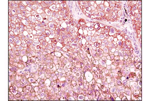 Immunohistochemistry Image 2: Annexin A2 (D11G2) Rabbit mAb