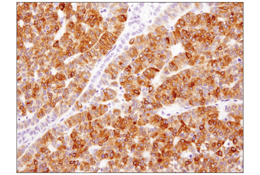Immunohistochemistry Image 1: Aromatase (D5Q2Y) Rabbit mAb