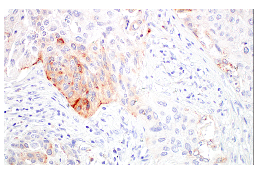 Immunohistochemistry Image 5: LAMP3/CD208 (E6E5U) XP<sup>®</sup> Rabbit mAb (BSA and Azide Free)