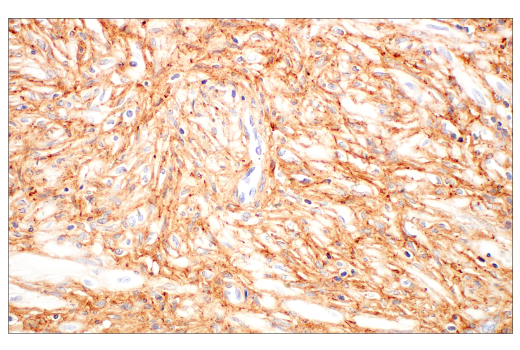 Immunohistochemistry Image 7: COL14A1 (E5W8S) Rabbit mAb (BSA and Azide Free)