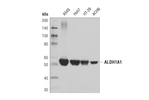 Western Blotting Image 1: ALDH1A1 (D9Q8E) XP<sup>®</sup> Rabbit mAb