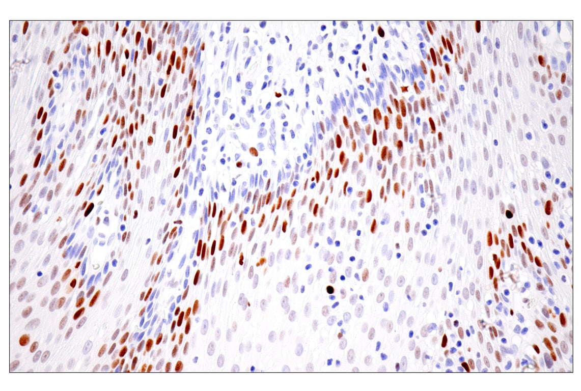 Immunohistochemistry Image 11: UHRF1 (E5W8W) Rabbit mAb