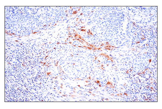 Immunohistochemistry Image 4: Phospho-SLP-76 (Ser376) (E3G9U) XP<sup>®</sup> Rabbit mAb