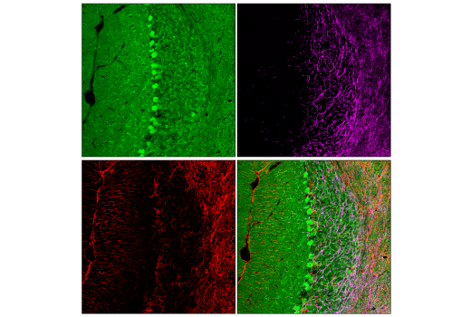 Immunofluorescence Image 3: CDK5 (D1F7M) Rabbit mAb