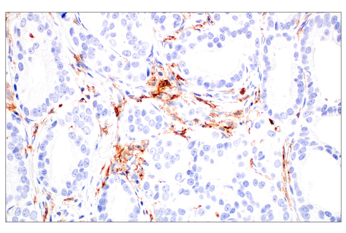 Immunohistochemistry Image 4: CD11b/ITGAM (E3J2F) Rabbit mAb