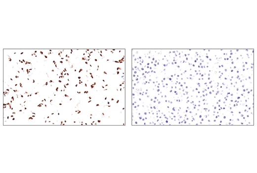 Immunohistochemistry Image 4: SS18-SSX (E9X9V) XP<sup>®</sup> Rabbit mAb (BSA and Azide Free)