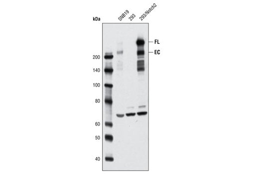 Western Blotting Image 1: Notch2 (8A1) Rabbit mAb