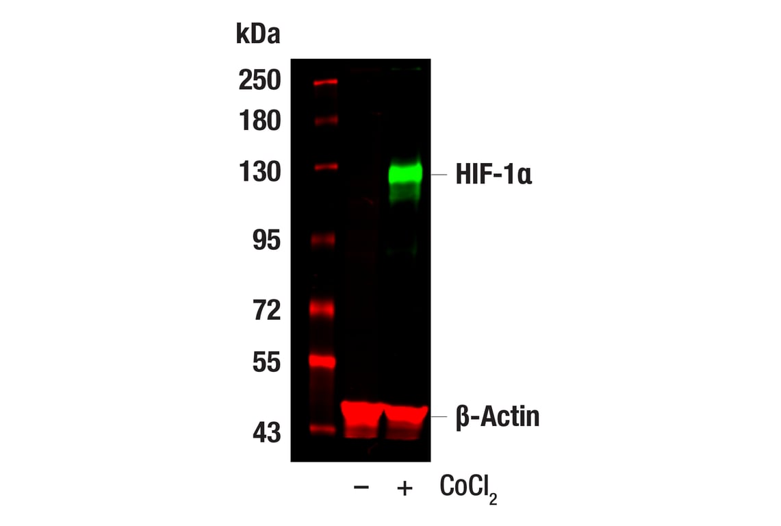 undefined Image 9: Microglia Neurodegeneration Module Antibody Sampler Kit