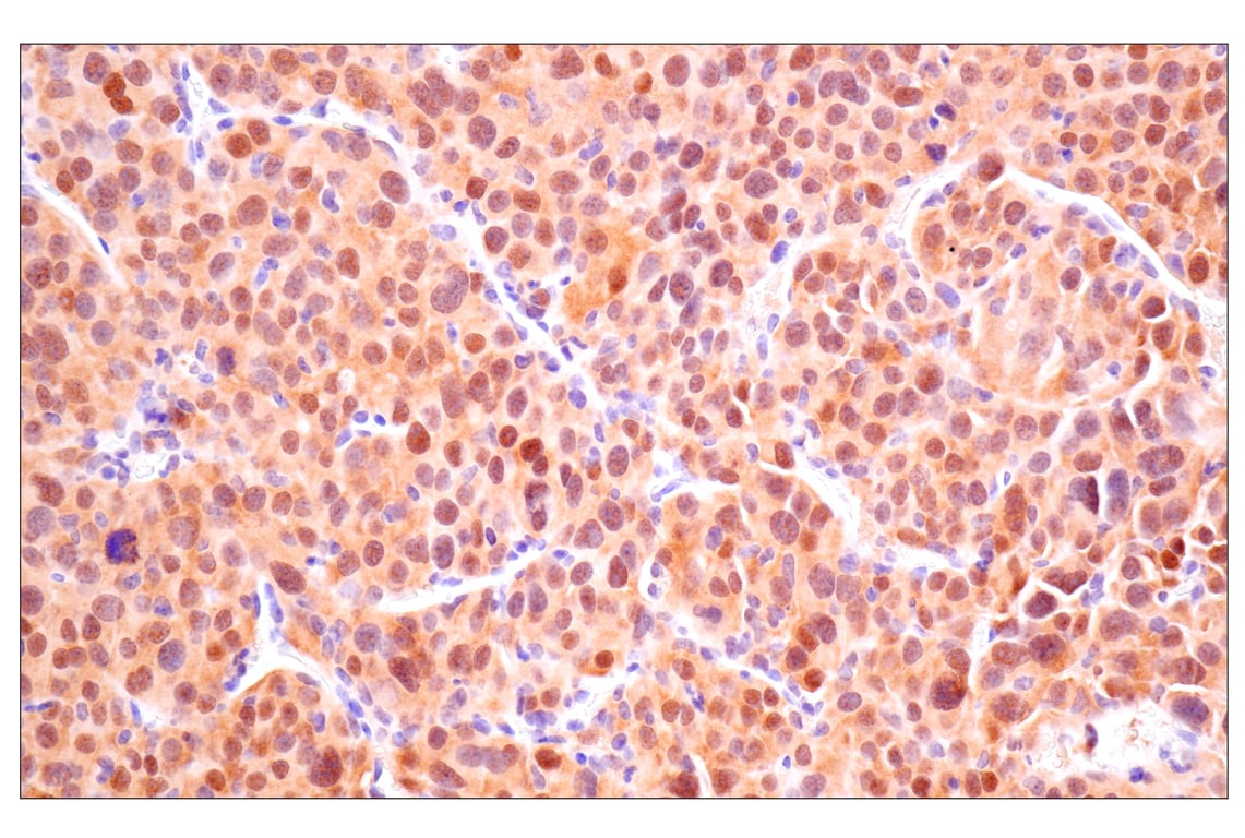 Immunohistochemistry Image 9: ACBP/DBI (E4V8V) XP<sup>®</sup> Rabbit mAb