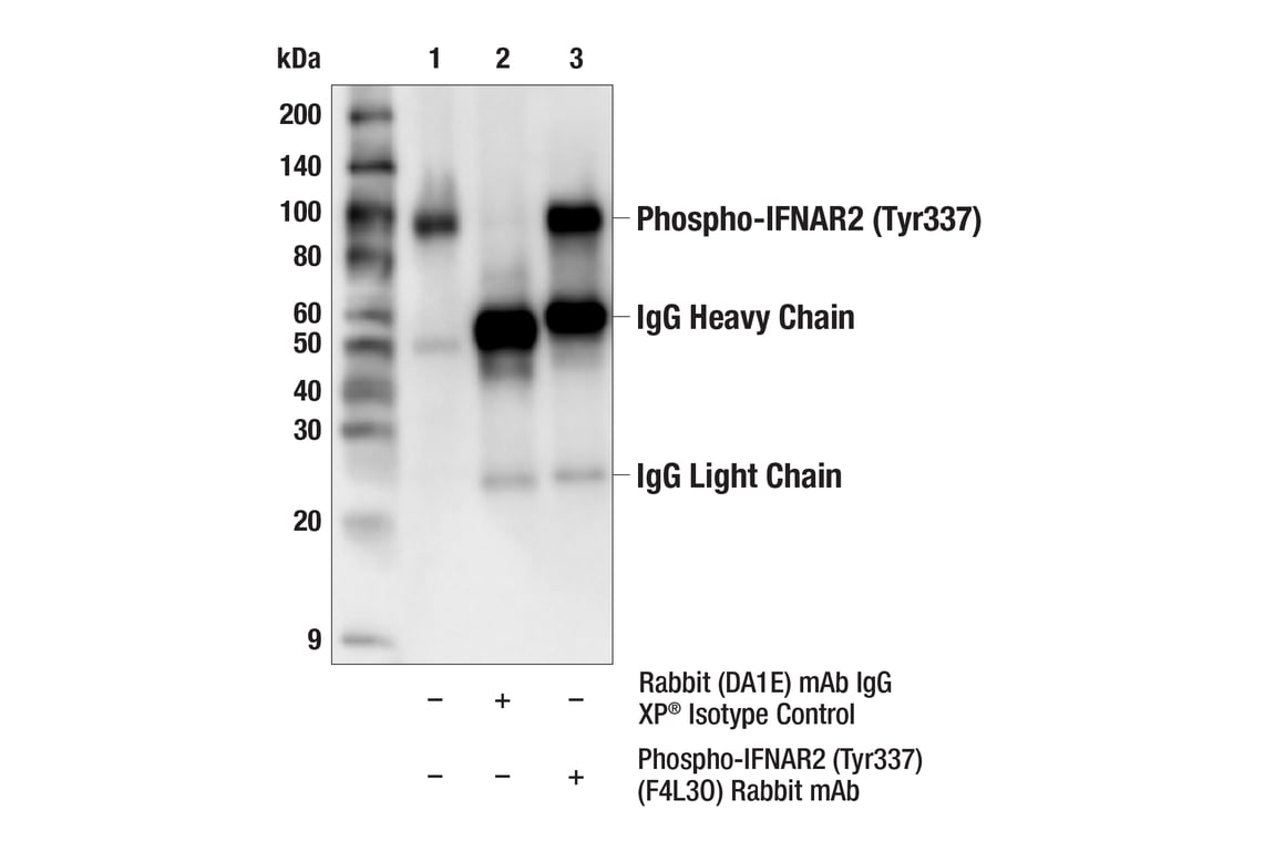 Immunoprecipitation Image 1: Phospho-IFNAR2 (Tyr337) (F4L3O) Rabbit mAb