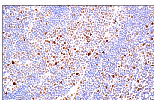 Immunohistochemistry Image 2: Ezh2 (D2C9) XP<sup>®</sup> Rabbit mAb (BSA and Azide Free)