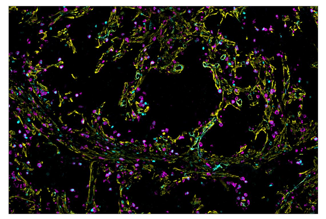 Immunohistochemistry Image 2: T-bet/TBX21 (E4I2K) & CO-0077-647 SignalStar<sup>™</sup> Oligo-Antibody Pair