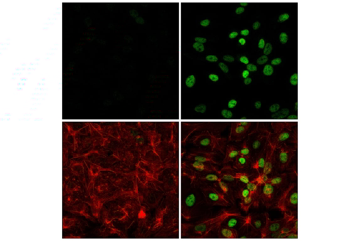 Immunofluorescence Image 1: HIF-1α (E1V6A) Rabbit mAb
