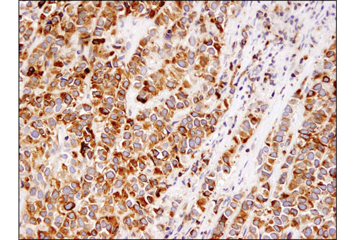 Immunohistochemistry Image 1: Bcl-2 (124) Mouse mAb (BSA and Azide Free)