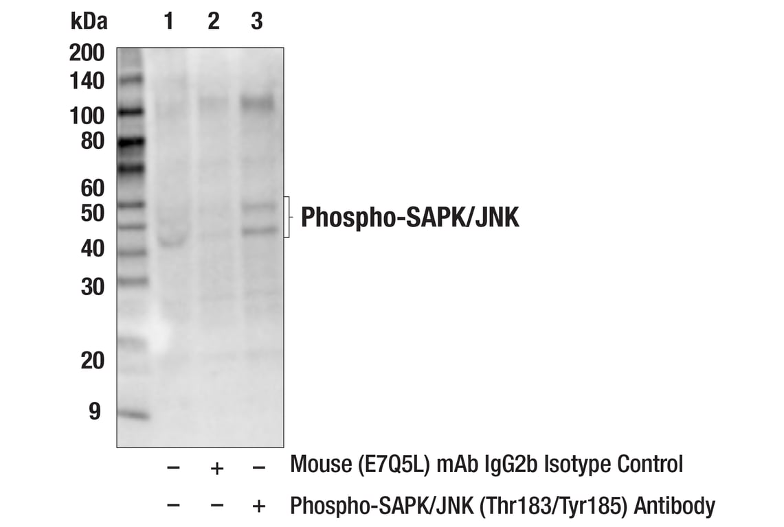 Immunoprecipitation Image 1: Phospho-SAPK/JNK (Thr183/Tyr185) Antibody