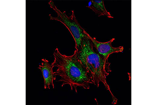 undefined Image 33: Glutamine Metabolism Antibody Sampler Kit