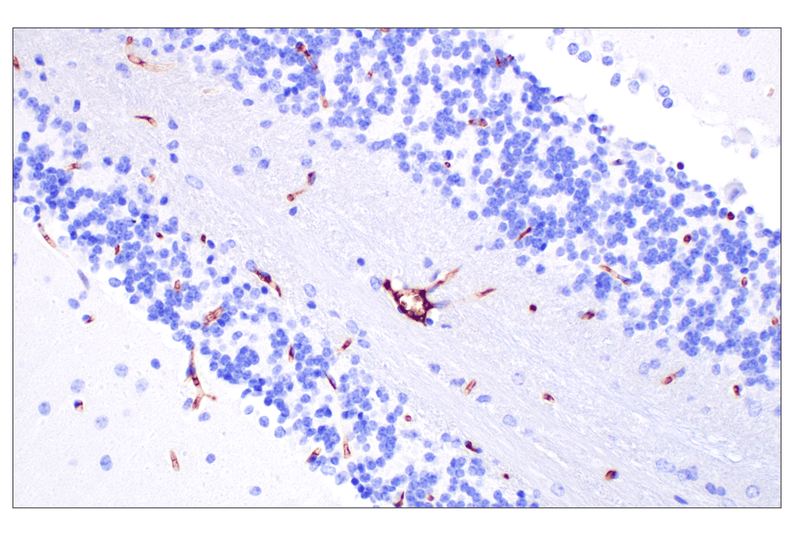 Immunohistochemistry Image 4: PNPLA3 (E7N6O) Rabbit mAb (BSA and Azide Free)