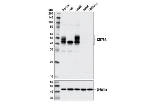 undefined Image 2: B Cell Signaling Antibody Sampler Kit II
