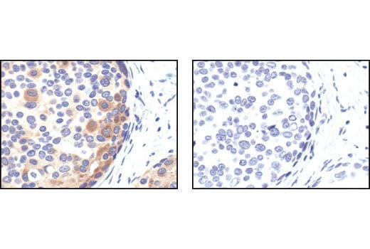 undefined Image 2: PhosphoPlus<sup>®</sup> Bad (Ser112) Antibody Duet