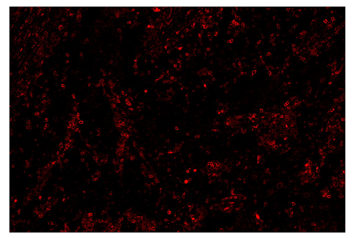 Immunohistochemistry Image 4: Phospho-SLP-76 (Ser376) (E3G9U) & CO-0018-750 SignalStar<sup>™</sup> Oligo-Antibody Pair