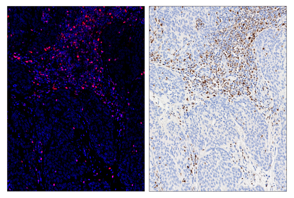 Immunohistochemistry Image 4: T-bet/TBX21 (E4I2K) & CO-0077-647 SignalStar<sup>™</sup> Oligo-Antibody Pair