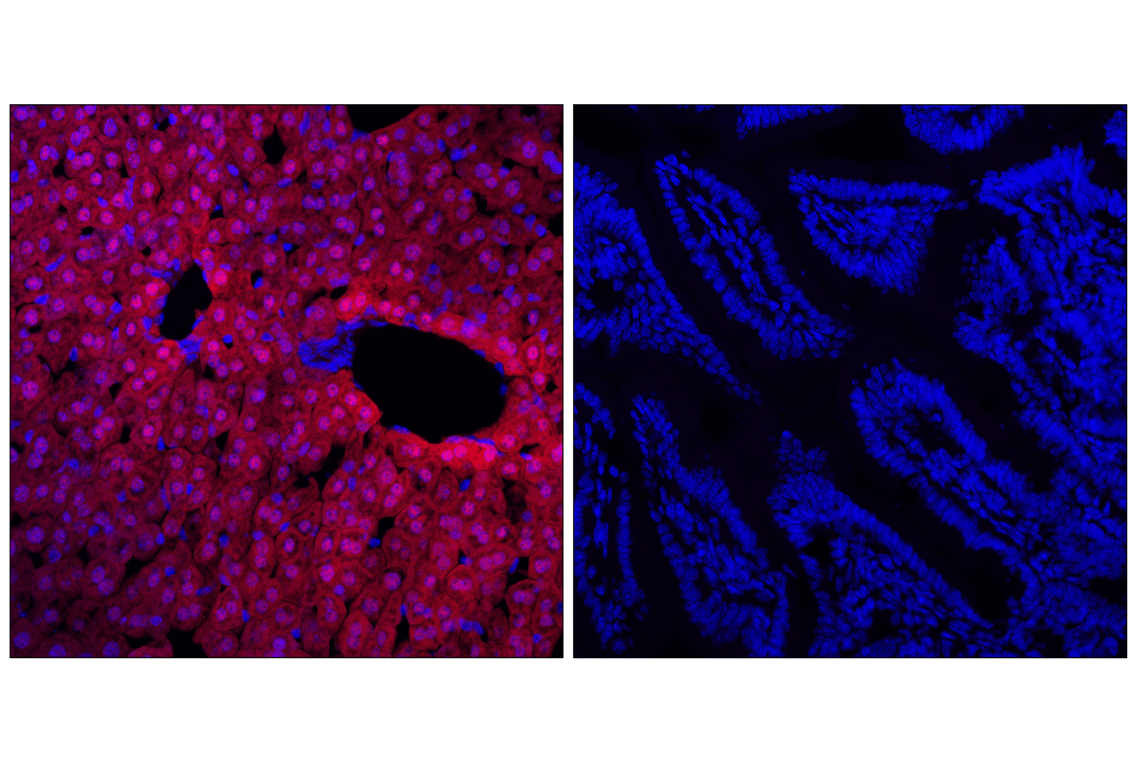 Immunofluorescence Image 1: Arginase-1 (D4E3M<sup>™</sup>) XP<sup>®</sup> Rabbit mAb (Alexa Fluor<sup>®</sup> 555 Conjugate)