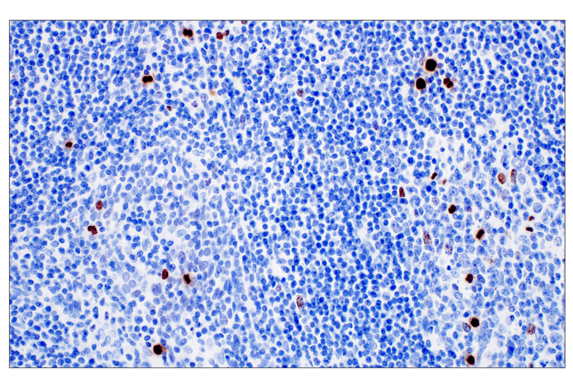 Immunohistochemistry Image 7: Phospho-Histone H3 (Ser10) (D7N8E) XP<sup>®</sup> Rabbit mAb (BSA and Azide Free)