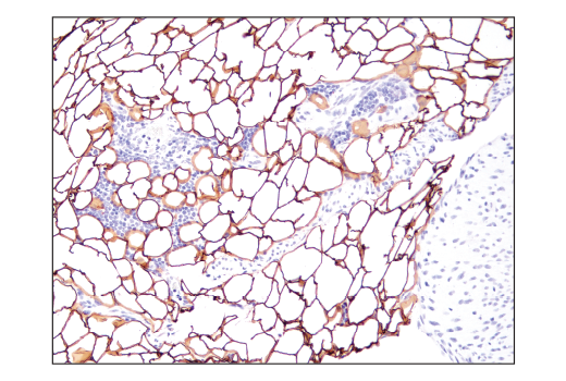 Immunohistochemistry Image 5: Perilipin-1 (D1D8) XP<sup>®</sup> Rabbit mAb