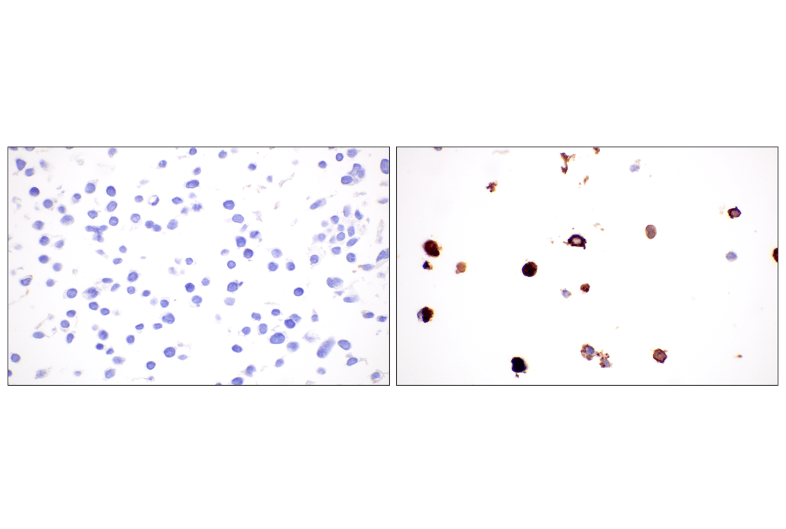 Immunohistochemistry Image 8: CD27 (F3R2V) Rabbit mAb