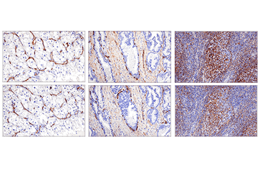 Immunohistochemistry Image 5: CD200 (E5I9V) XP<sup>®</sup> Rabbit mAb (BSA and Azide Free)