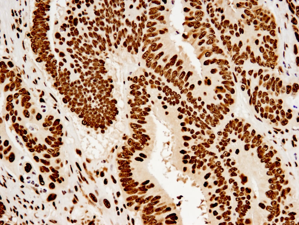 Immunohistochemistry Image 2: Nucleolin (D4C7O) Rabbit mAb