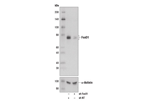 Western Blotting Image 2: FoxO1 (D7C1H) Mouse mAb