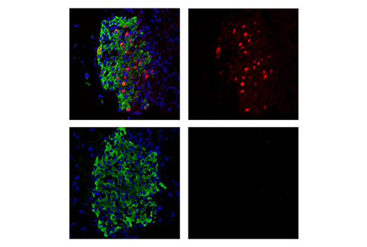 Immunofluorescence Image 1: Cre Recombinase (D7L7L) XP<sup>®</sup> Rabbit mAb (BSA and Azide Free)