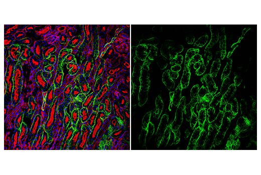 Immunofluorescence Image 3: AQP4 (D1F8E) XP<sup>®</sup> Rabbit mAb (Alexa Fluor<sup>®</sup> 488 Conjugate)