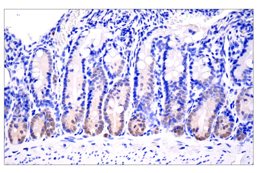 undefined Image 84: Human Exhausted CD8<sup>+</sup> T Cell IHC Antibody Sampler Kit