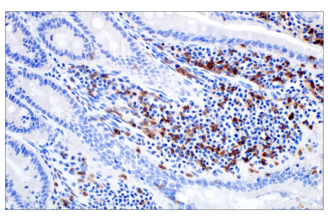 Immunohistochemistry Image 5: CD4 (D7D2Z) Rabbit mAb (BSA and Azide Free)