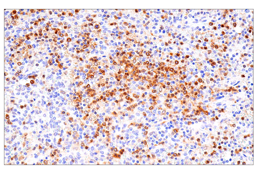 Immunohistochemistry Image 7: DAP12 (E8P9U) Rabbit mAb (BSA and Azide Free)